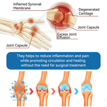 (Aeehfeng®) Only 10 boxes left! Enjoy an extra 30% off today! Clinically proven to relieve arthritis pain, stiffness, and inflammation—just 6 to 10 bottles can cure all types of arthritis. Don't wait another year—act now!