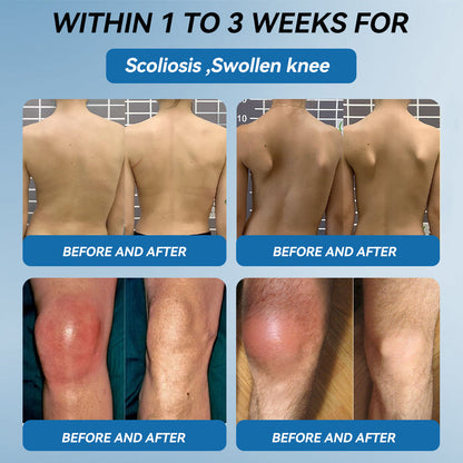 (Aeehfeng®) Only 10 boxes left! Enjoy an extra 30% off today! Clinically proven to relieve arthritis pain, stiffness, and inflammation—just 6 to 10 bottles can cure all types of arthritis. Don't wait another year—act now!