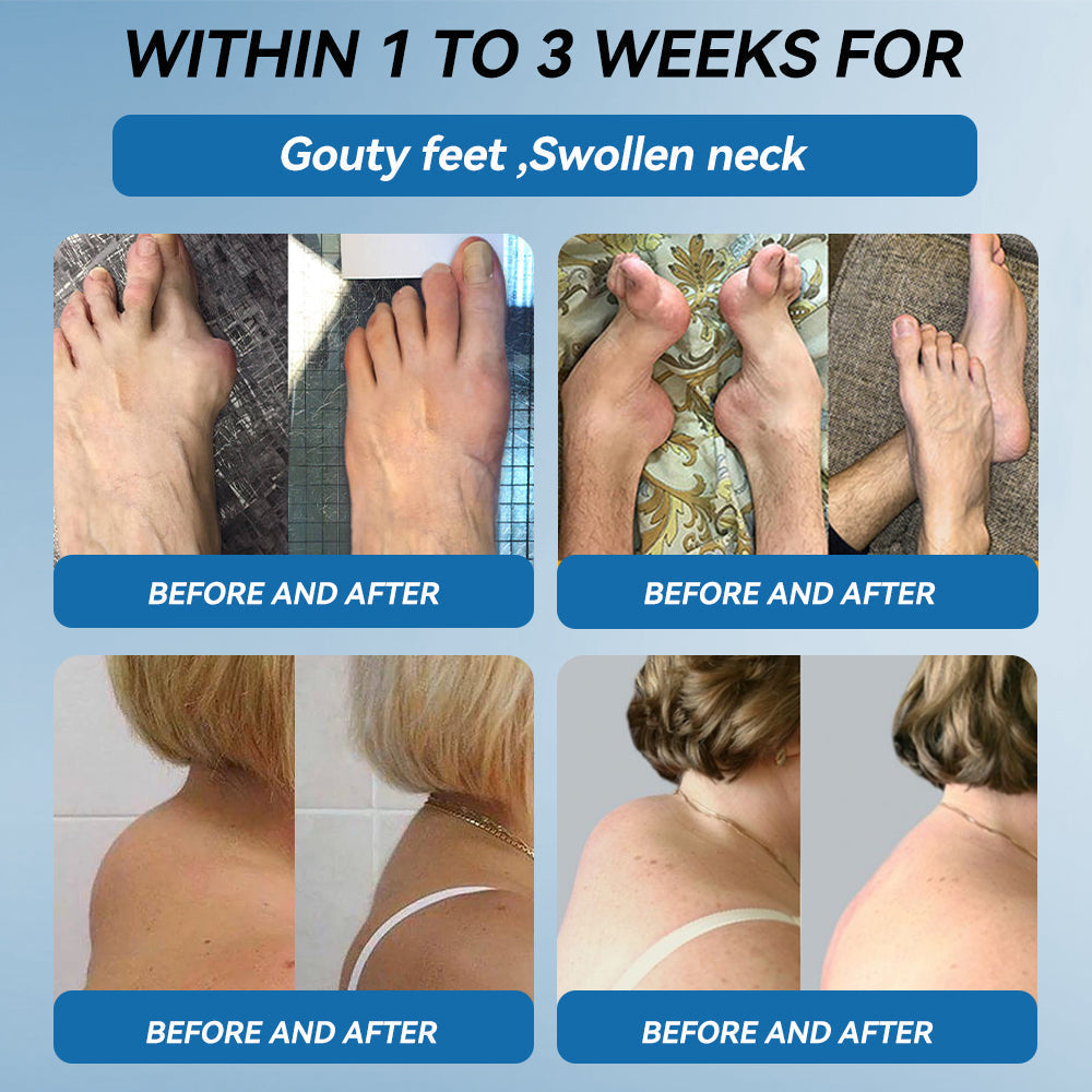 (Aeehfeng®) Only 10 boxes left! Enjoy an extra 30% off today! Clinically proven to relieve arthritis pain, stiffness, and inflammation—just 6 to 10 bottles can cure all types of arthritis. Don't wait another year—act now!